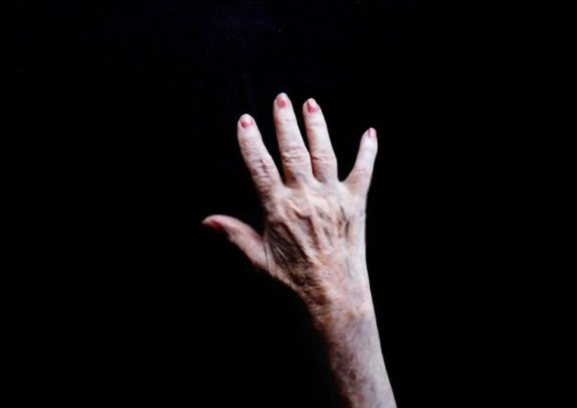 Do You Have Veiny Hands? Here’s Why &Amp; What It Means! 1 607Dbee57Cf7F 1