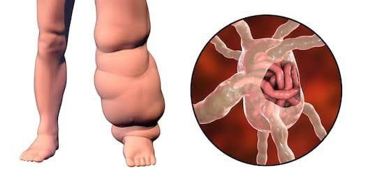 Waterborne Diseases!- The Hidden Treat Of Your Daily Water! 8 Img 20200525 174659