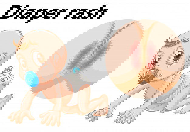 Baby With Diaper Rash 1308 16918 1