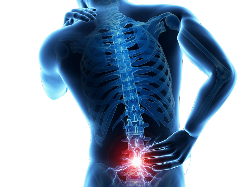 Kisspng Low Back Pain Human Back Back Injury Vertebral Col Back Pain 5Ac31F06C688C2.0677219815227369028132
