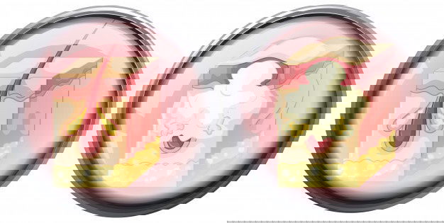 Skincare Tips For Oily Skin- The Ultimate Guide To Understand &Amp; Treat Acne! 21 Skin Acne White Background 1308 16587