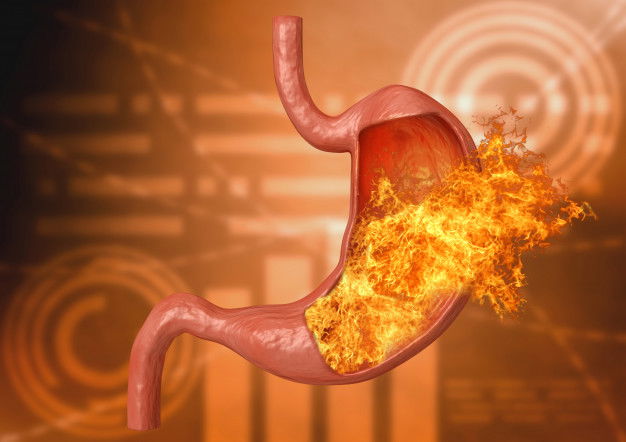 Stomach Fire Excessive Acidity Indigestion Stomach Disease 59529 543 1