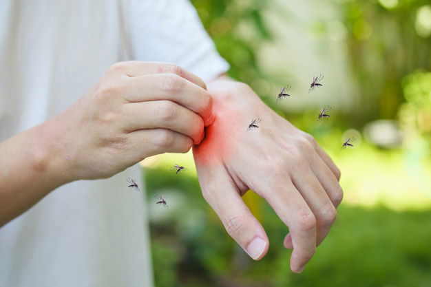 Why Do Mosquitoes Bite Some People More Than Others? 2 Man Itching Scratching Hand From Allergy Skin Rash Cause By Mosquitoes Bite 293060 1451