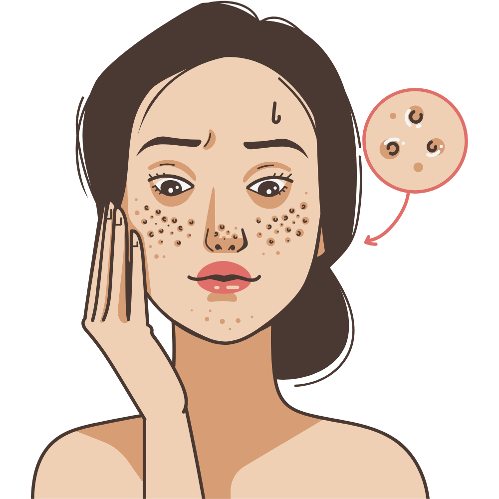 “Minimizes the pores for a smooth and refined skin texture” “Tightens pores and helps achieve clearer, flawless skin”