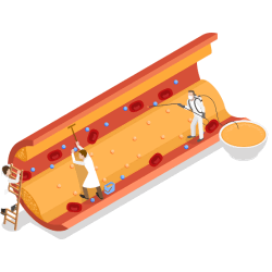 the human heart with arrows pointing to areas that can be damaged by high lipid levels.