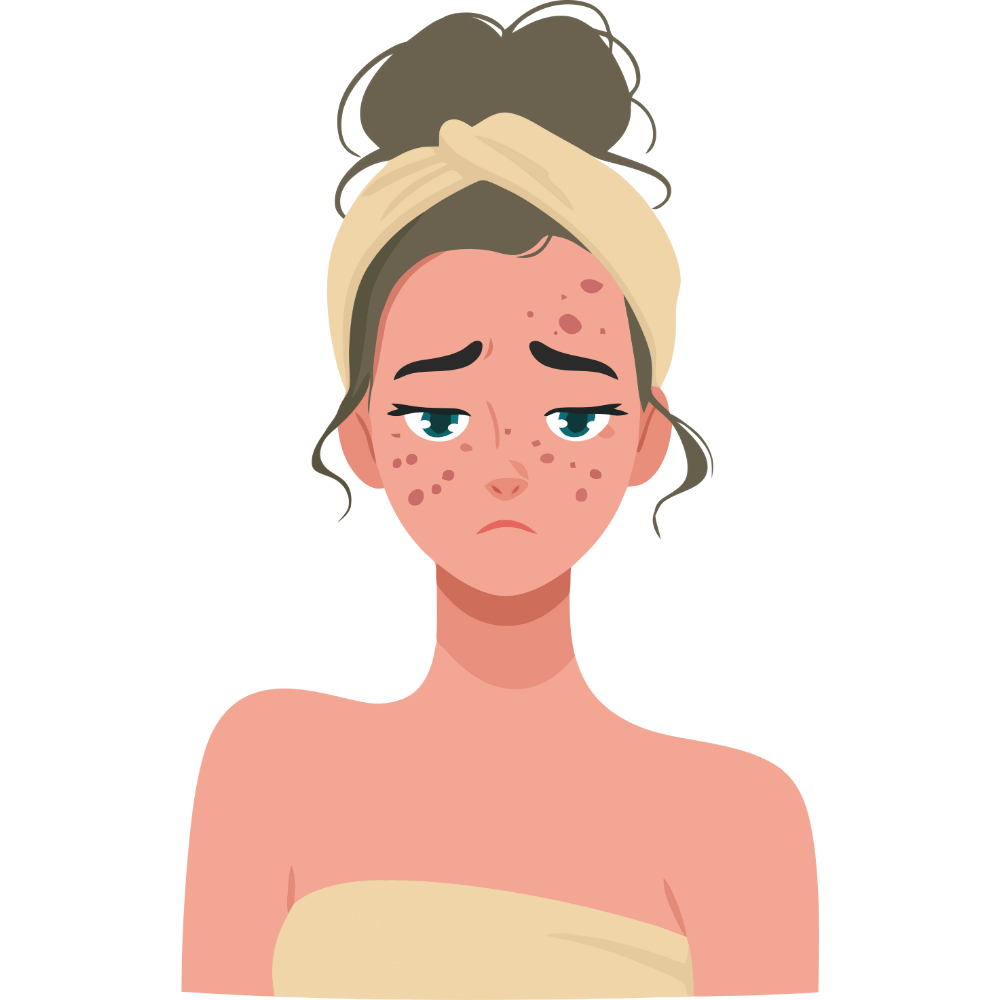 Neem soap – natural soap that helps clear acne and promotes a healthy, blemish-free complexion