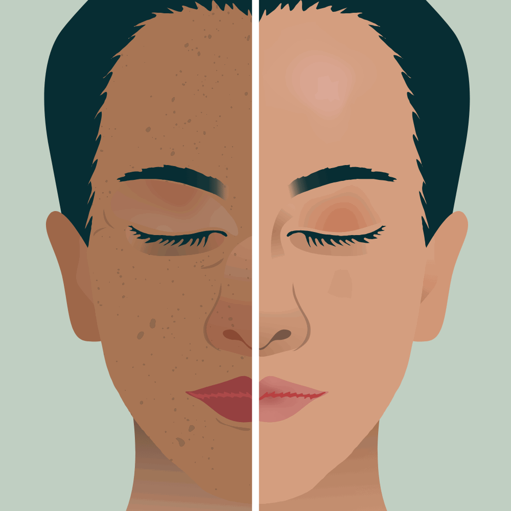 “Helps reduce tan and restores natural skin tone” “Natural formula that lightens sun tan and evens skin”