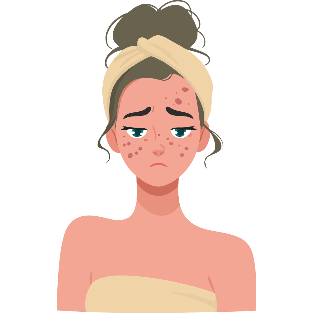 “Helps in preventing pimples and maintaining clear skin” “Natural formula that controls excess oil and prevents pimples”