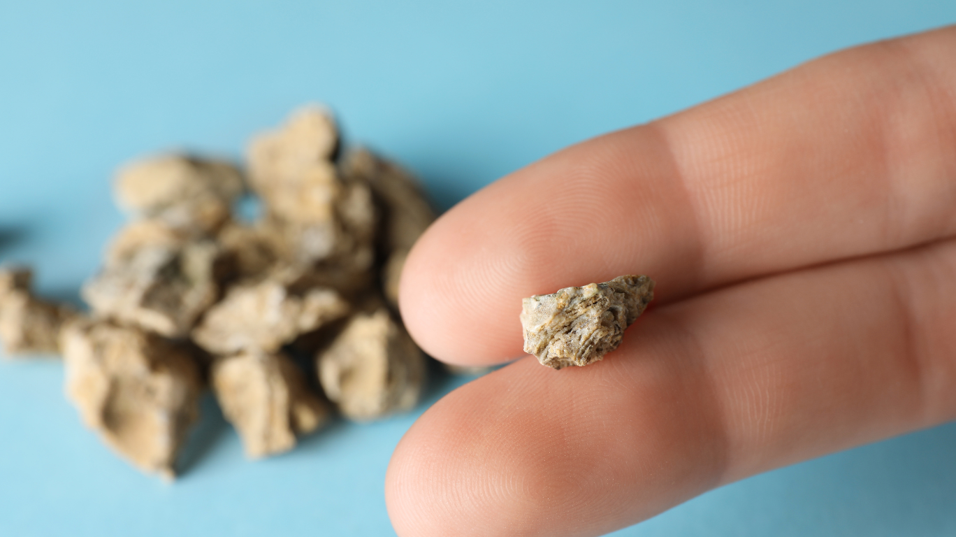 Plenty Of Water Is One Of The Most Effective Ways To Prevent The Formation Of Kidney Stones,