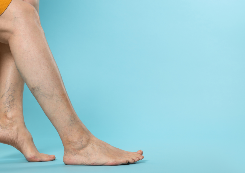 Do You Have Veiny Hands? – Let’s Look At The Reasons!