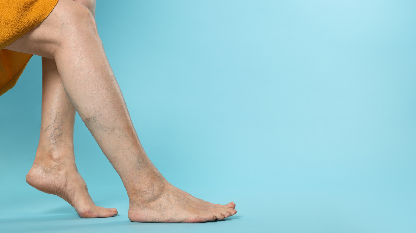 Do You Have Veiny Hands? – Let’s Look At The Reasons!