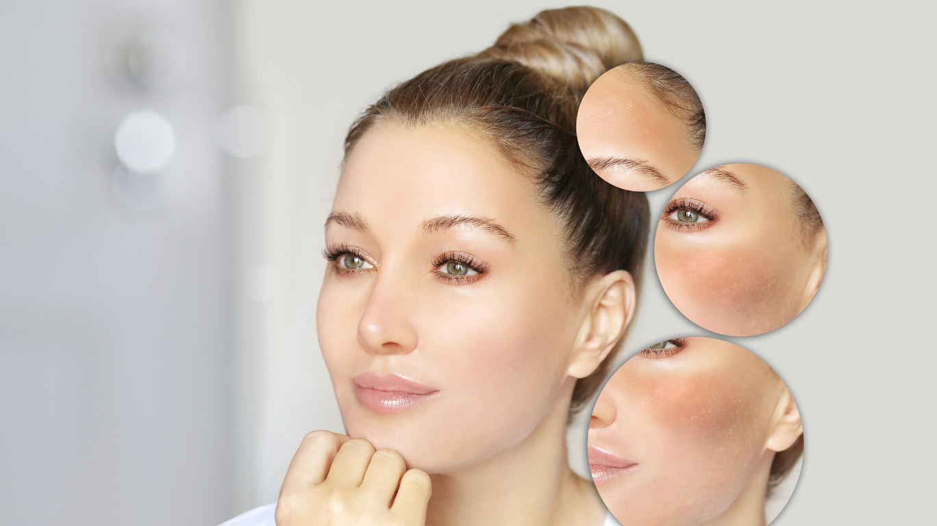 A Person Drinking A Glass Of Water, Showcasing The Importance Of Hydration For Maintaining Healthy, Glowing Skin.
