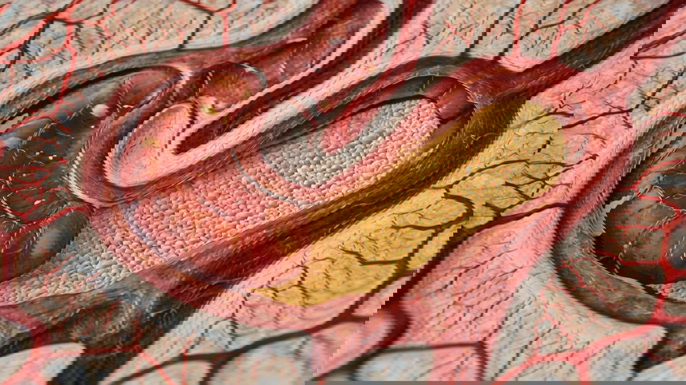 How Black Dates Keep Your Arteries Clean And Healthy