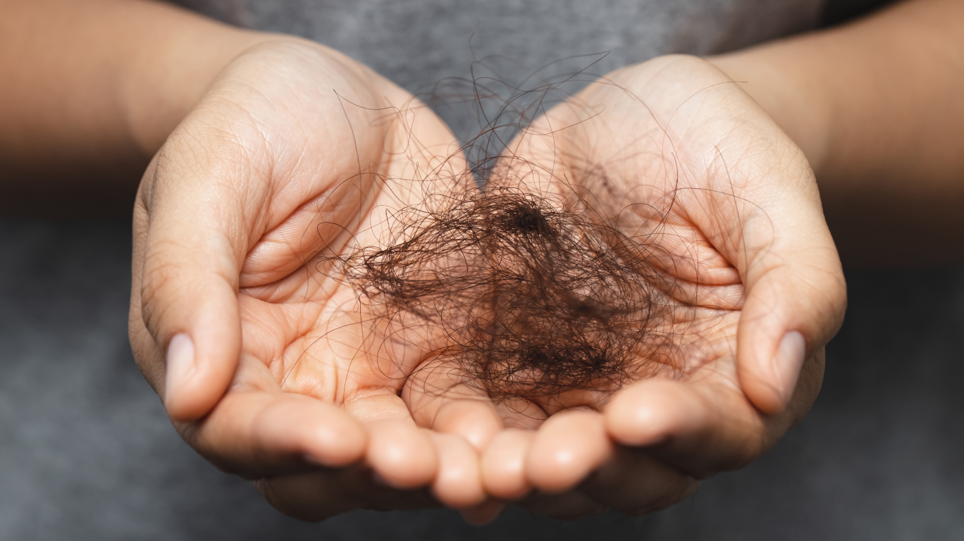 Ich In Vitamin E And Healthy Fats, It Moisturizes The Scalp, Reducing Dryness And Preventing Dandruff.