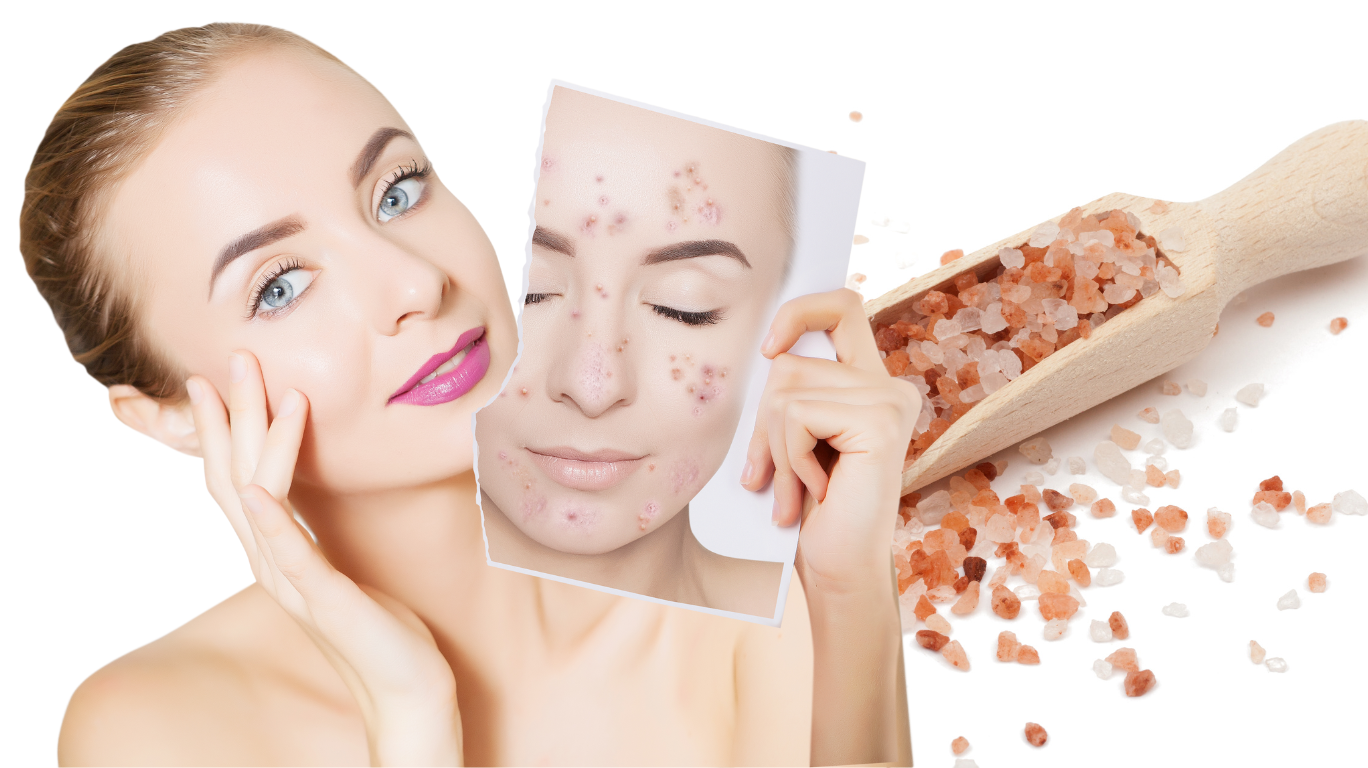 &Quot;Himalayan Salt For Acne: Use As A Toner To Cleanse, Balance, And Soothe Your Skin Naturally