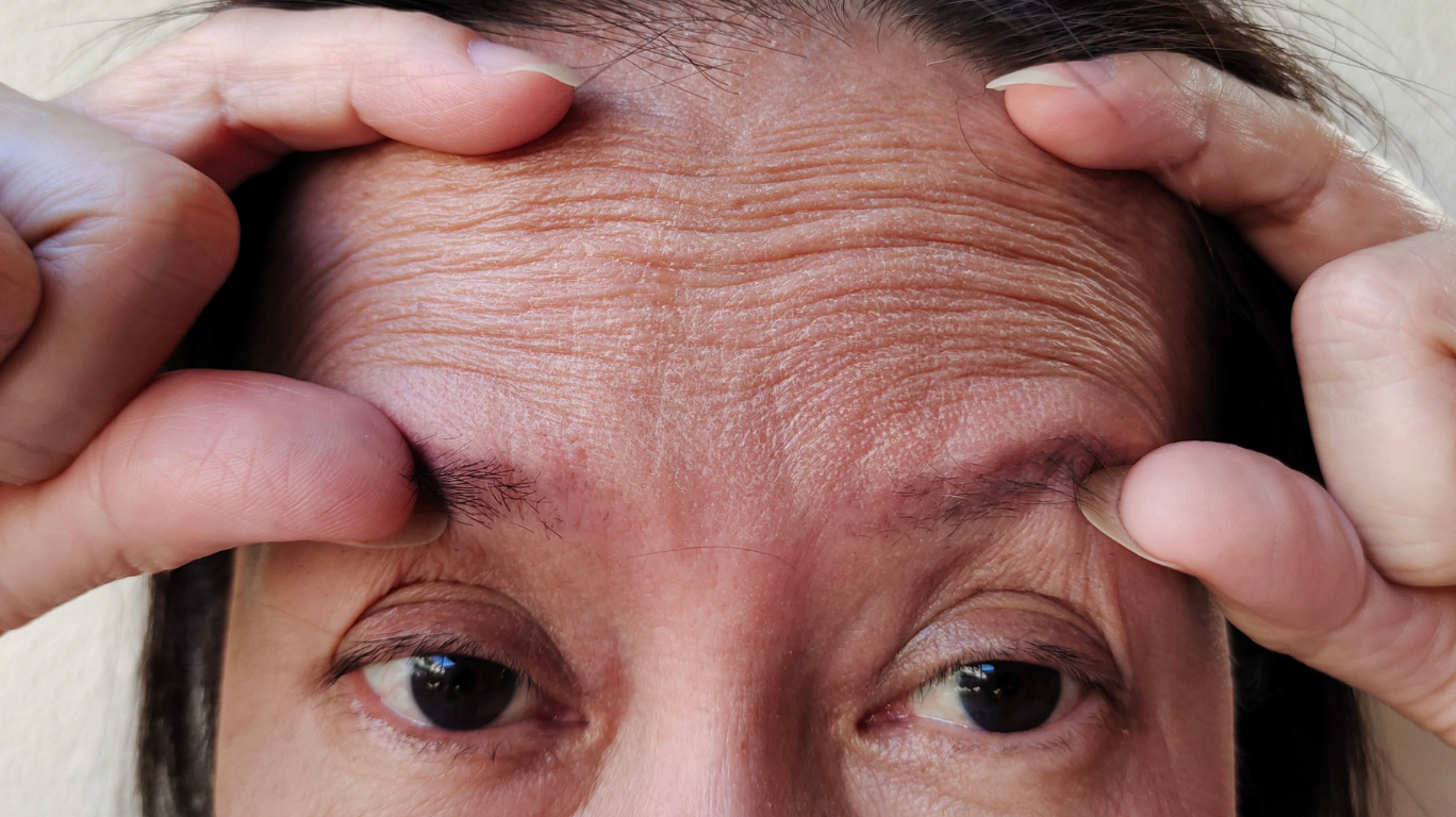 15 Must Know Tips Of Castor Oil! 7 Castor Oil For Wrinkles – Deeply Nourishes Skin, Boosts Collagen, And Reduces Fine Lines Naturally