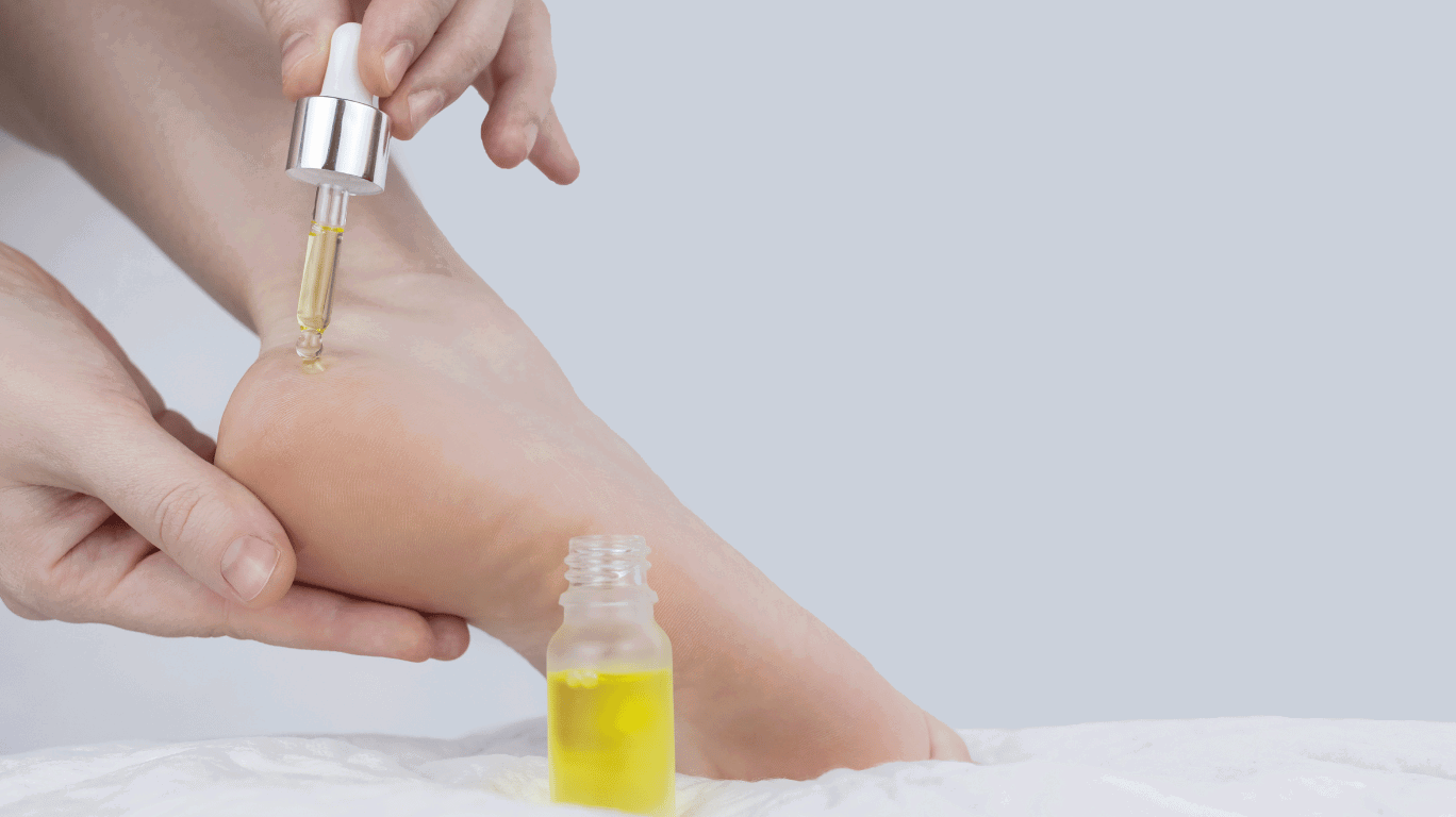 Mustard Oil – A Natural Insect Repellent That Keeps Mosquitoes, Bugs, And Pests Away With Its Strong Aroma And Antibacterial Properties.