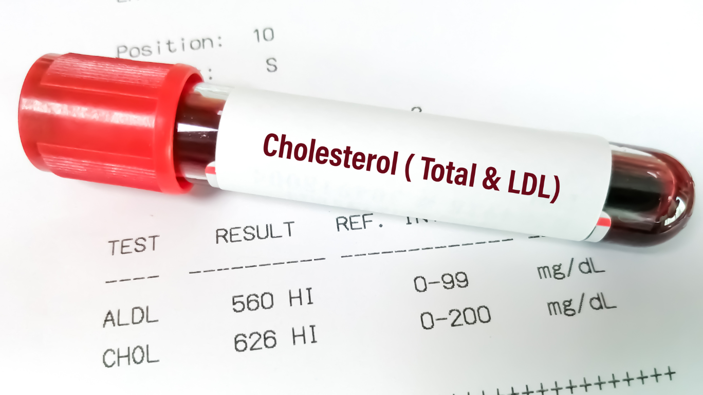 Cholesterol Levels