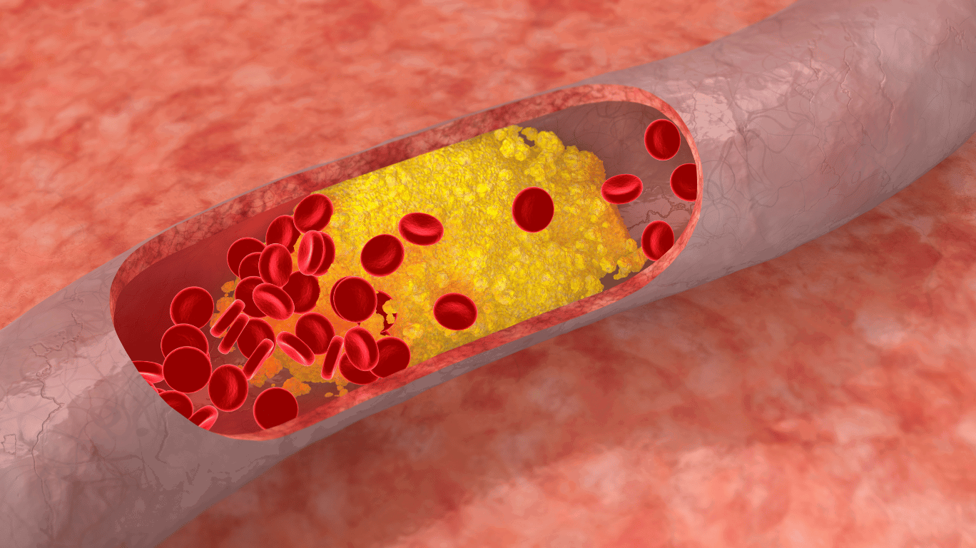 நல்லெண்ணெயில் உள்ள லெசித்தின் மற்றும் லினோலிக் அமிலம் இரத்தத்தில் கெட்ட கொழுப்பை (Ldl) கரைத்து நல்ல கொழுப்பின் (Hdl) அளவை அதிகரிக்கும் செயல்முறை விளக்கம்.