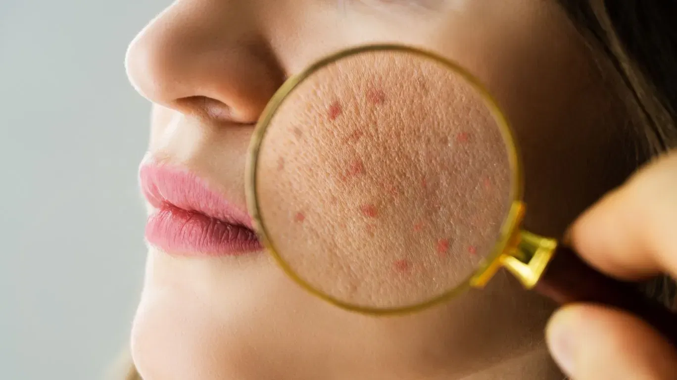 Cold Pressed Coconut Oil மசாஜ் வலி மற்றும் சோர்வை குறைக்கும்.
மூட்டுகளில் இரத்தச் சுழற்சி மேம்பட்டு நலமளிக்கும்.
தசைகள் தளர்ந்து உடல் ஓய்வாகும்.
வாரத்தில் 2 முறை சூடேற்றி மசாஜ் செய்யலாம்